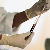 Norma krvného testu, aký je jeho význam