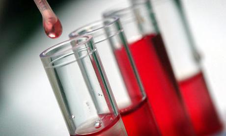 Zvýšené bielych krviniek v krvi: aké sú príčiny a aká je liečba?